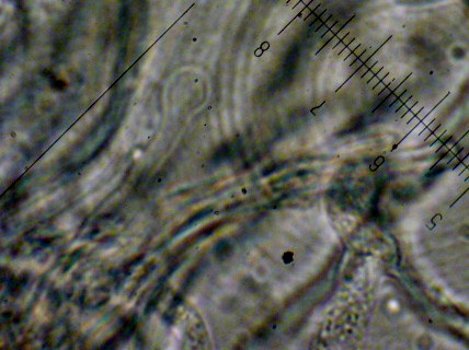 Lindtneria trachyspora (Tulasnella violea)